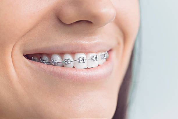 Best Teeth Whitening  in Aurora, MN